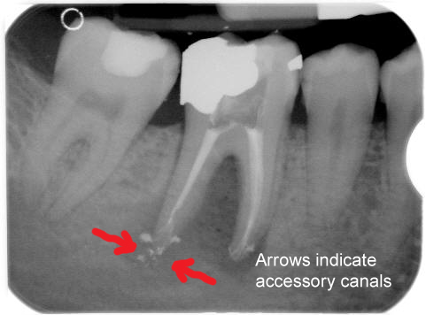 Rowtree Dental Care | | FAQ's