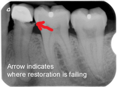 failing-restoration_edit