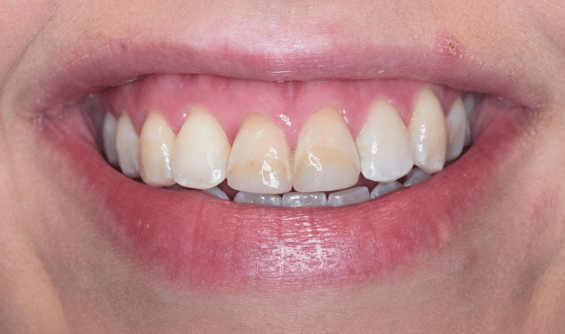 Before - Rowtree Dental Care