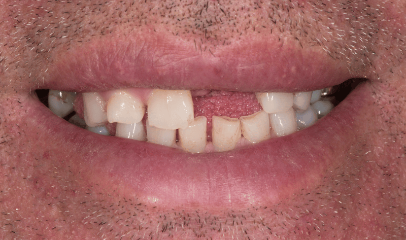 Before - Rowtree Dental Care