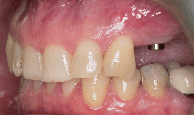 Before - Rowtree Dental Care