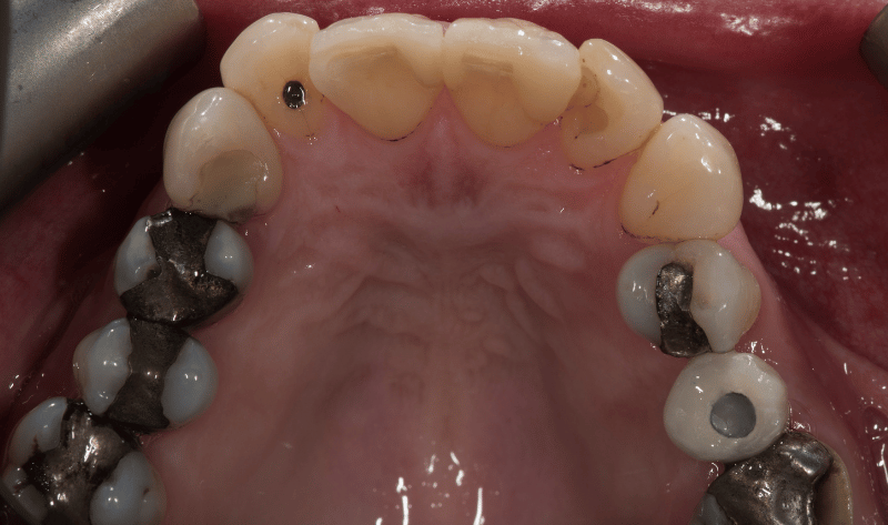After - Rowtree Dental Care