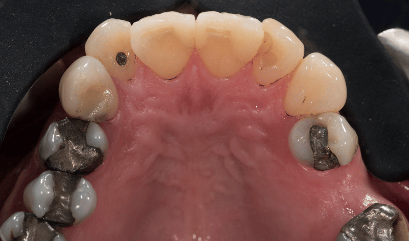 Before - Rowtree Dental Care