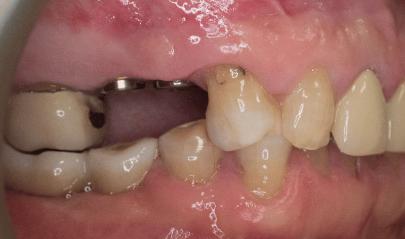 Before - Rowtree Dental Care