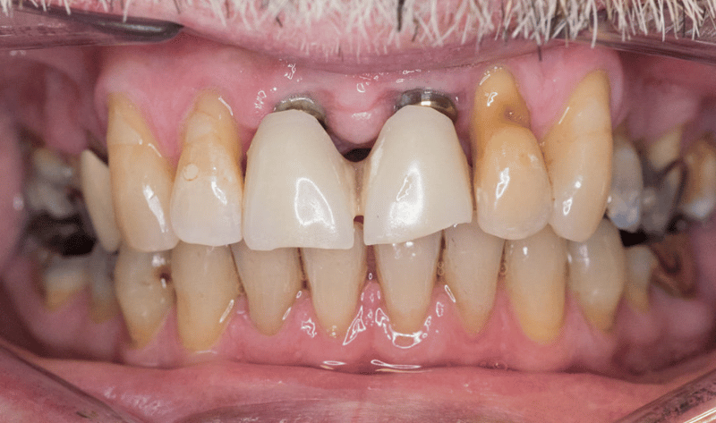 After - Rowtree Dental Care