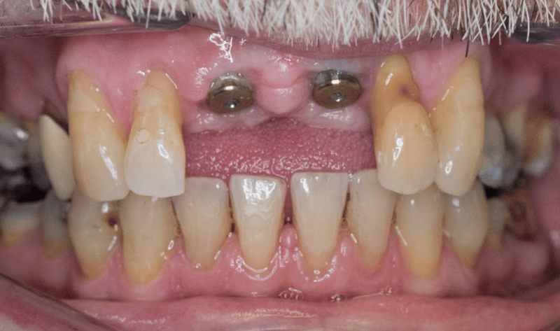 Before - Rowtree Dental Care