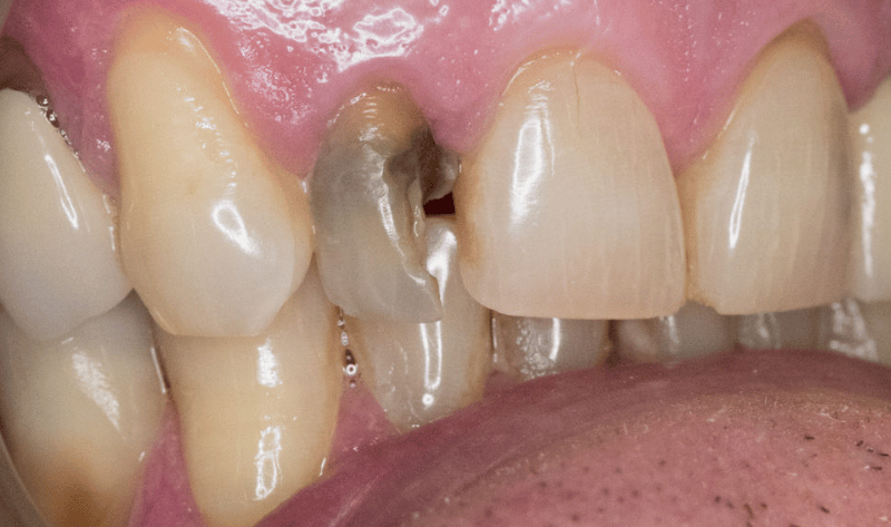 Before - Rowtree Dental Care