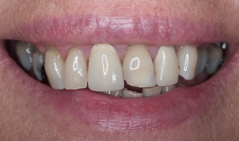 Before - Rowtree Dental Care