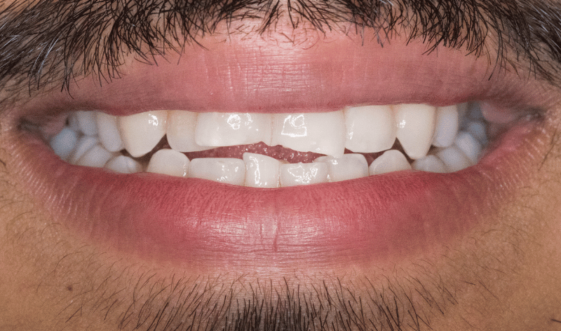 Before - Rowtree Dental Care