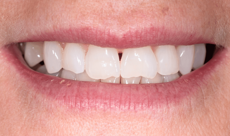 Before - Rowtree Dental Care